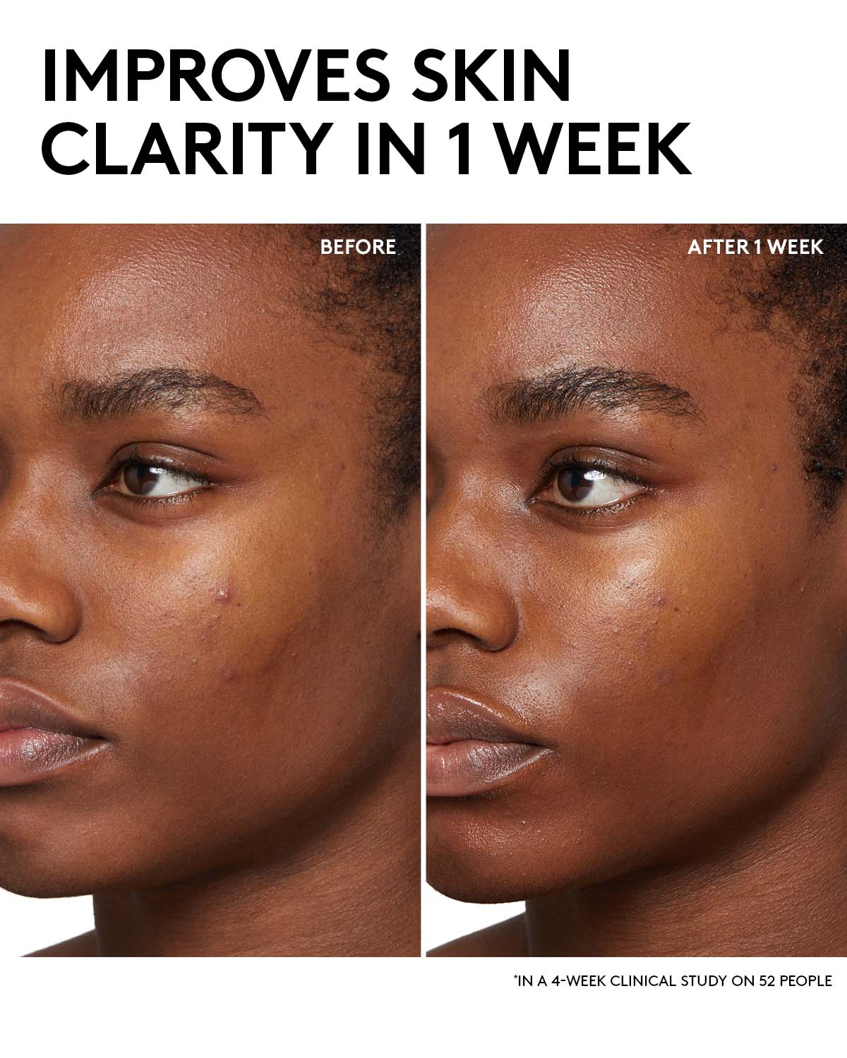 Cherry Dub BHA Toner with Salicylic Acid + Aloe Juice - Image 3